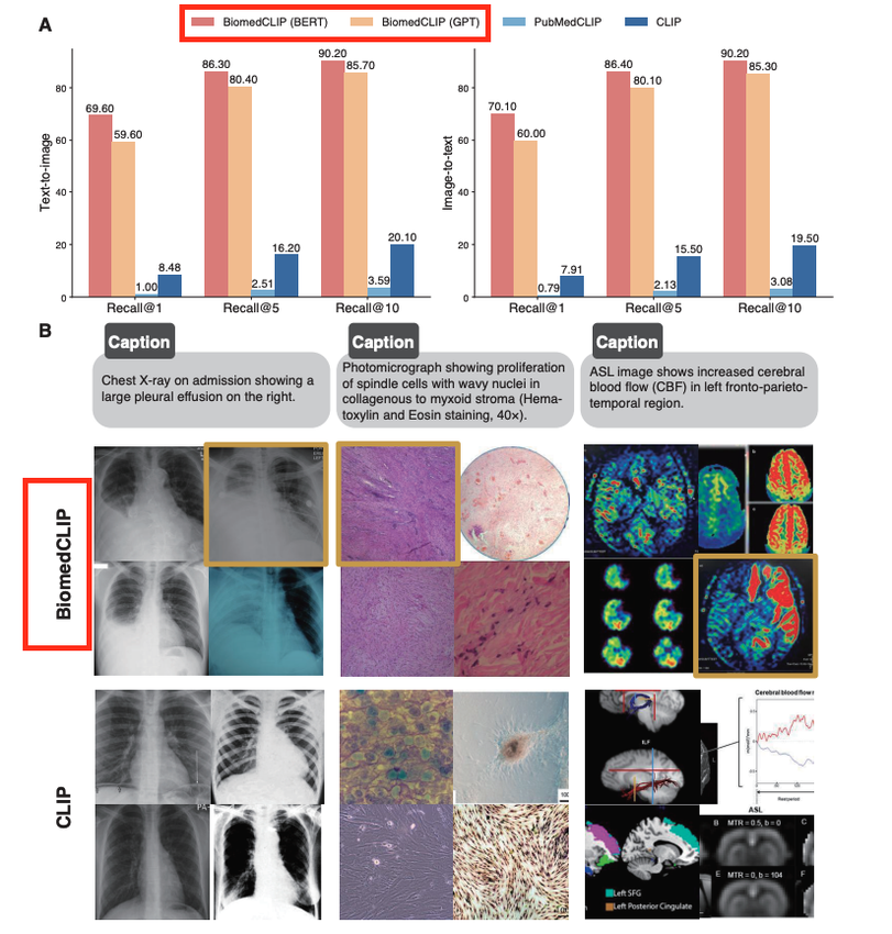 BiomedCLIP vs CLIP retrieval results showing superior medical image-text matching with qualitative examples