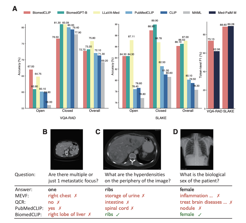 BiomedCLIP achieves state-of-the-art accuracy on VQA-RAD and SLAKE medical visual question answering datasets